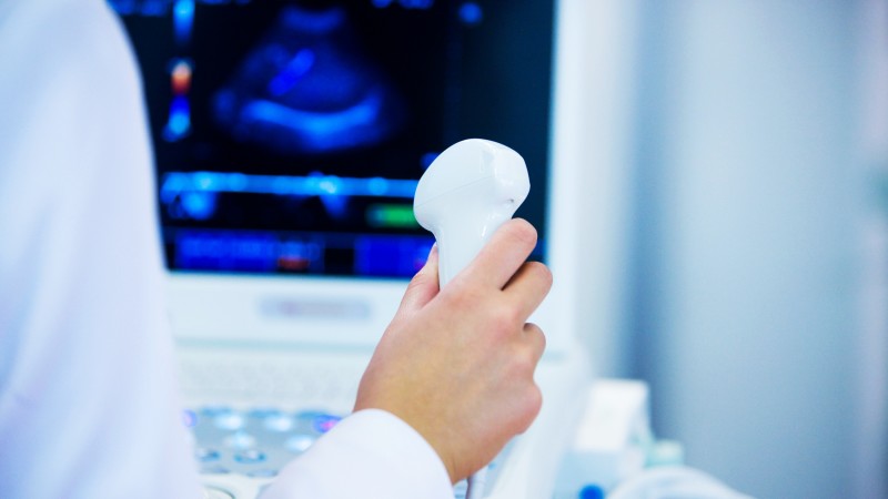 Closeup of technician holding ultrasound doppler and looking at screen