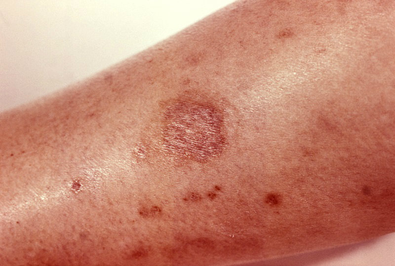 Ddx Can You Spot These Summer Health Hazards