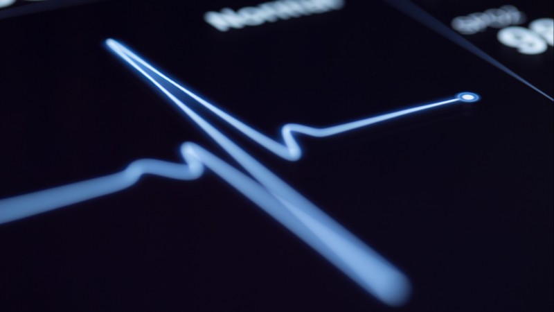 Close-up of a heartbeat on a machine.