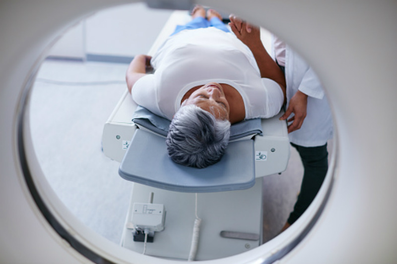 Unnecessary CT scans in breast cancer