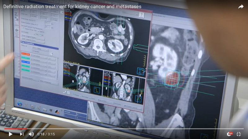 Stereotactic ablative radiation therapy