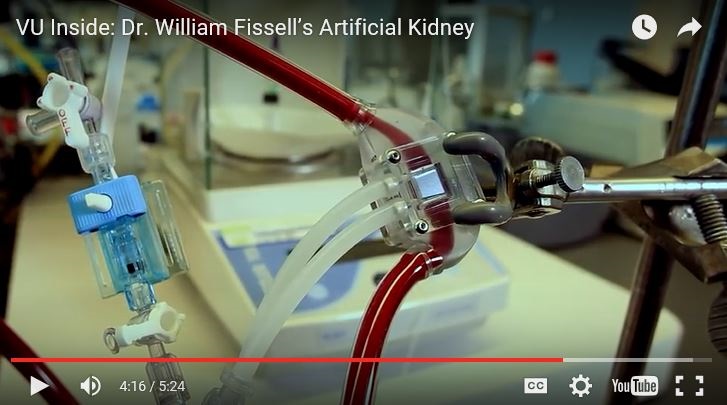 Artificial kidney at Vanderbilt University Medical Center (VUMC)