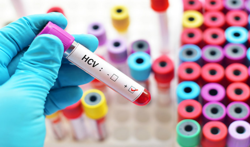 Expanding HCV screening