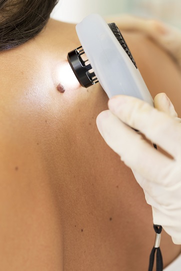 Melanoma survival double with these treatments